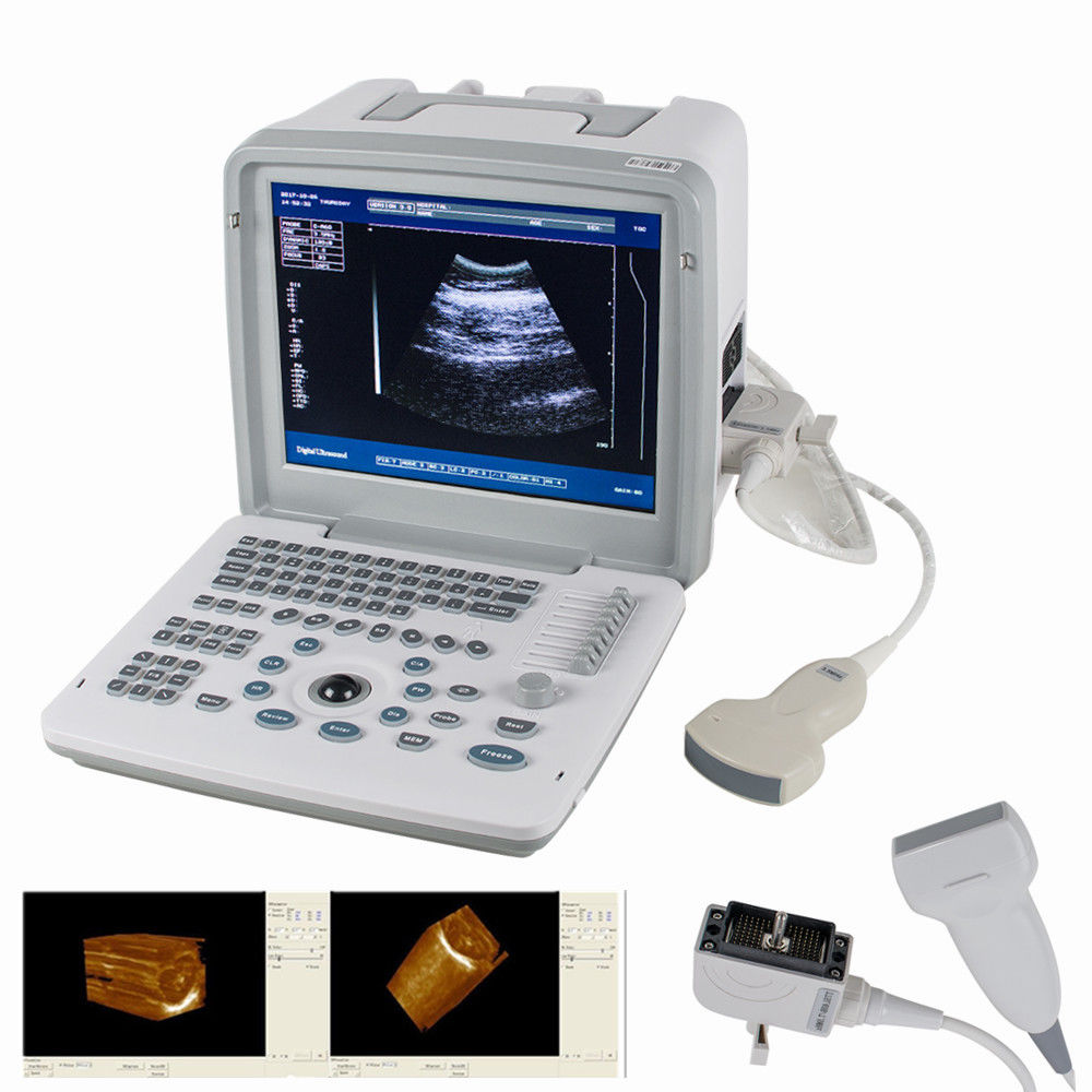 Digital SVGA 3D Portable Ultrasound Scanner Machine +Convex +Linear 2 Probes Med 190891597786 DIAGNOSTIC ULTRASOUND MACHINES FOR SALE