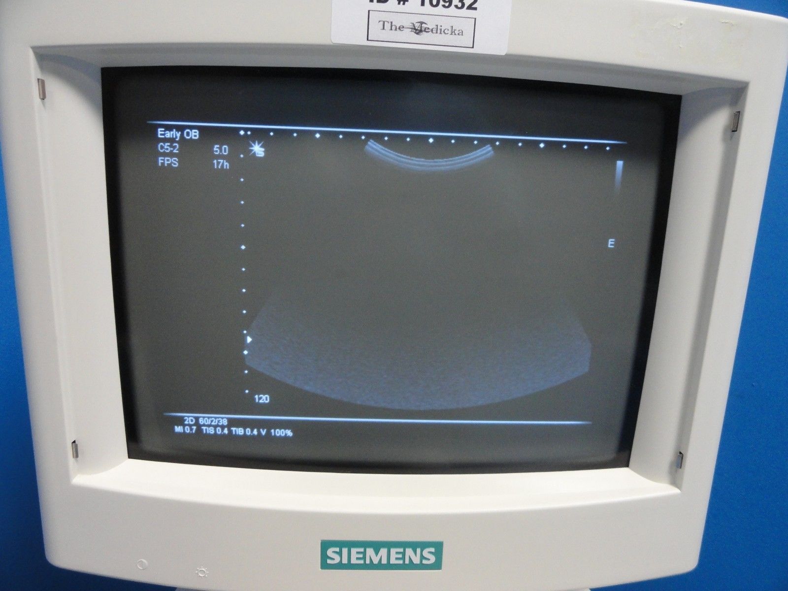 Siemens C5-2 Abdominal Currved Array Ultrasound Probe for Sonoline G20 (11456) DIAGNOSTIC ULTRASOUND MACHINES FOR SALE