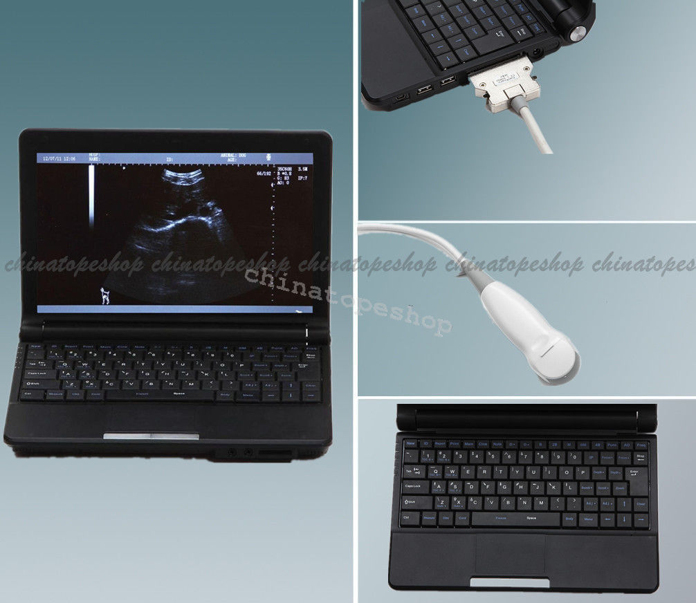 igital Laptop Notebook ultrasound scanner machine +Micro Convex probes Sale DIAGNOSTIC ULTRASOUND MACHINES FOR SALE