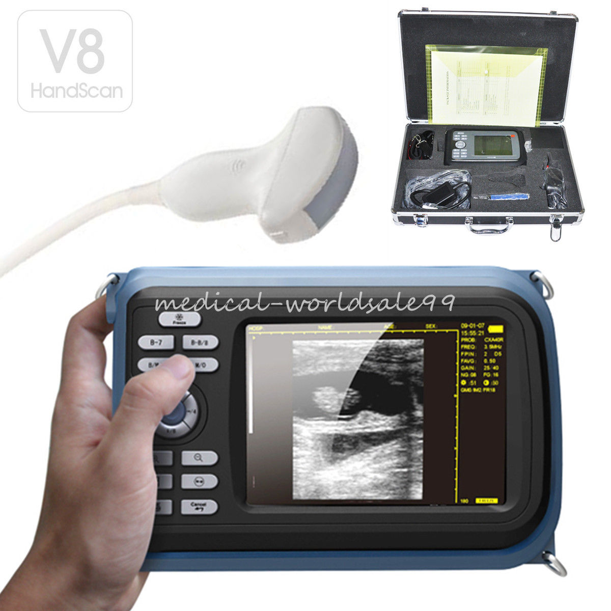 VET Handheld Ultrasound Scanner Machine  + Micro-Convex Probe/Sensor Animal CE 190891523389 DIAGNOSTIC ULTRASOUND MACHINES FOR SALE