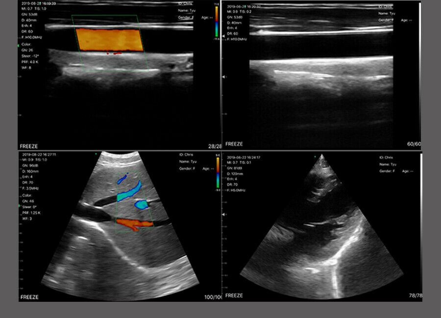 Wireless Dual Head Ultrasound Probe - Portable Color Scanner-Linear Convex probe DIAGNOSTIC ULTRASOUND MACHINES FOR SALE