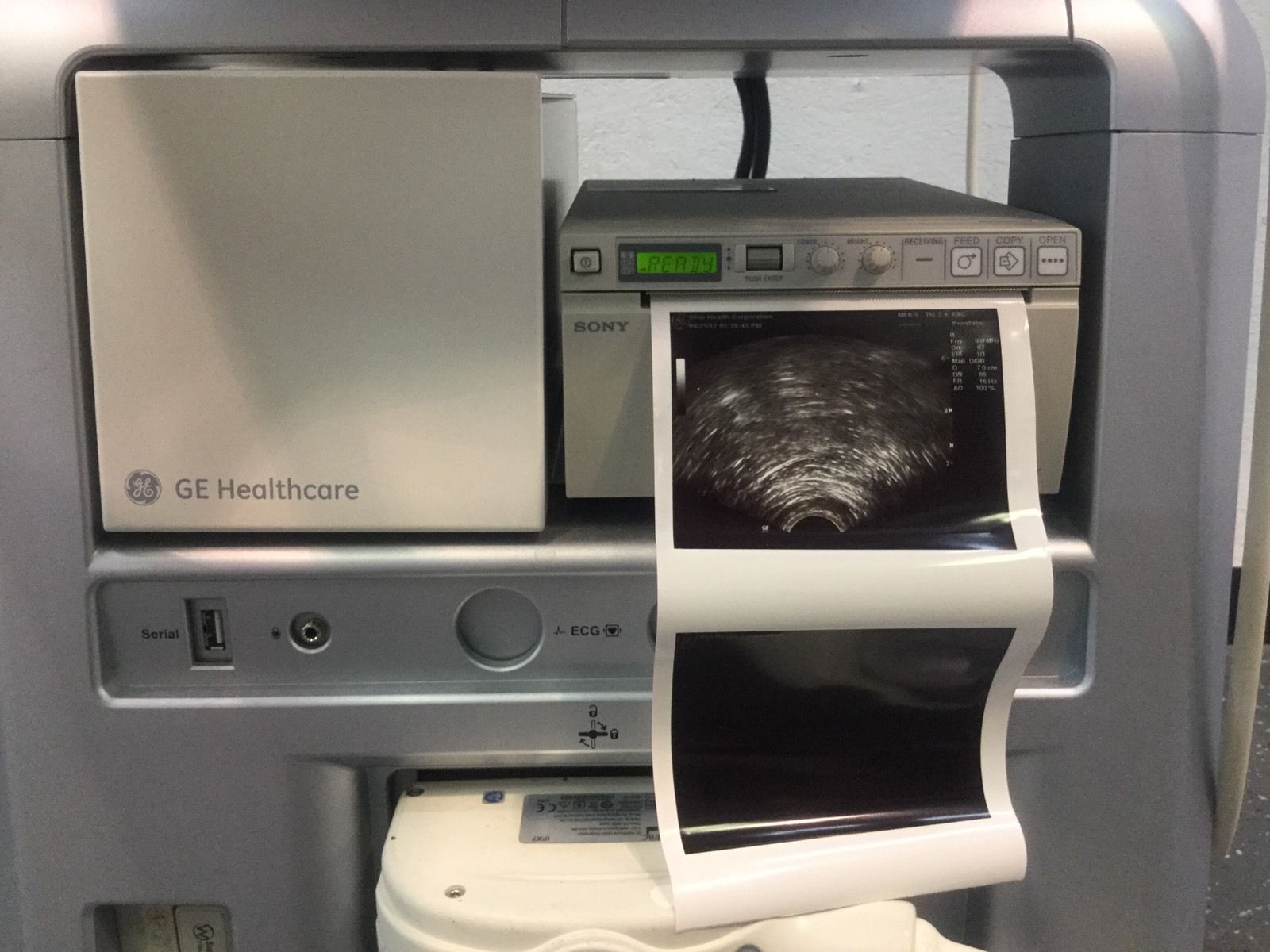 GE LOGIQ P5 2013 Ultrasound + Convex Volumetric Probe, endocavity Transducer DIAGNOSTIC ULTRASOUND MACHINES FOR SALE