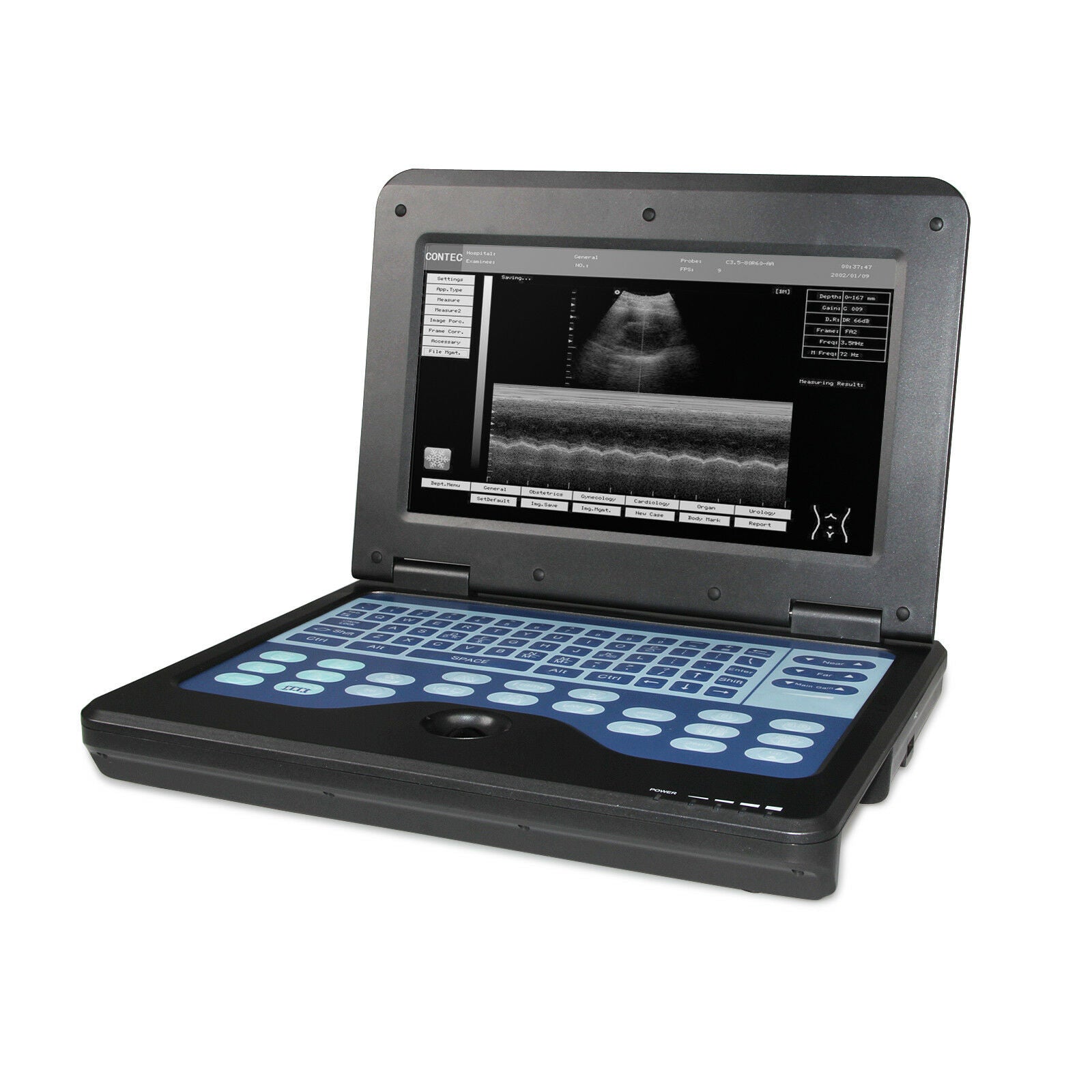 USA Seller,Digital Ultrasound Scanner Portable Laptop Ultrasound Machine+Convex DIAGNOSTIC ULTRASOUND MACHINES FOR SALE