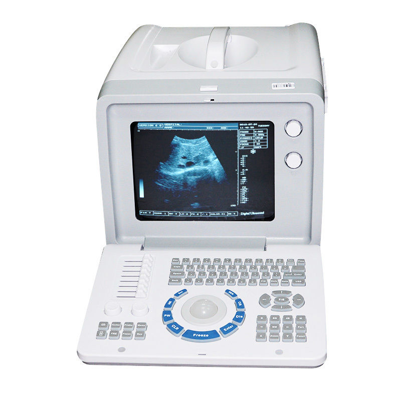 New Digital Ultrasound machine Scanner System Convex + linear Probe +3D Recorder DIAGNOSTIC ULTRASOUND MACHINES FOR SALE