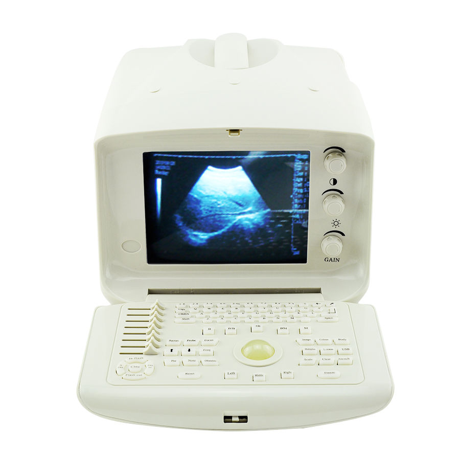 Portable Digital Ultrasound Scanner Machine CE, Convex + Transvaginal Probe 3D 190891052773 DIAGNOSTIC ULTRASOUND MACHINES FOR SALE