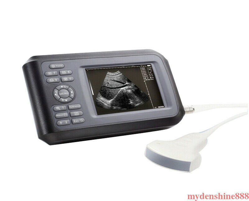 Portable Handheld Human Ultrasound Scanner Machine Monitor 3.5mhz Convex Probe DIAGNOSTIC ULTRASOUND MACHINES FOR SALE