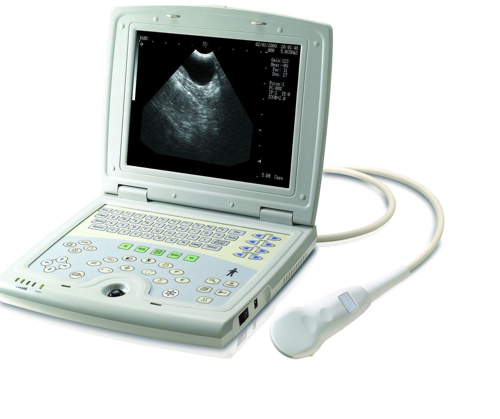 KX-5000V on Sale DIAGNOSTIC ULTRASOUND MACHINES FOR SALE