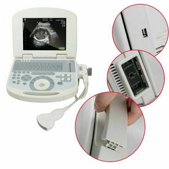 USA Portable Full Digital Laptop Medical Ultrasound Scanner+3.5mhz Convex probe DIAGNOSTIC ULTRASOUND MACHINES FOR SALE