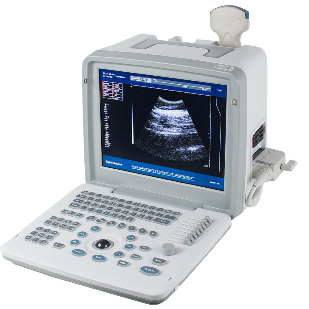 Portable Ultrasound Scanner Machine Convex Linear  2 Transducer +3D Free DIAGNOSTIC ULTRASOUND MACHINES FOR SALE