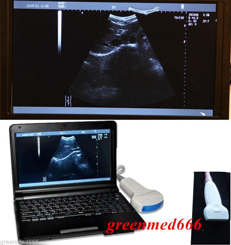 CE Full Digital Laptop Ultrasound Scanner Covex +Linear 2 Probe Sensor + 3D SW DIAGNOSTIC ULTRASOUND MACHINES FOR SALE