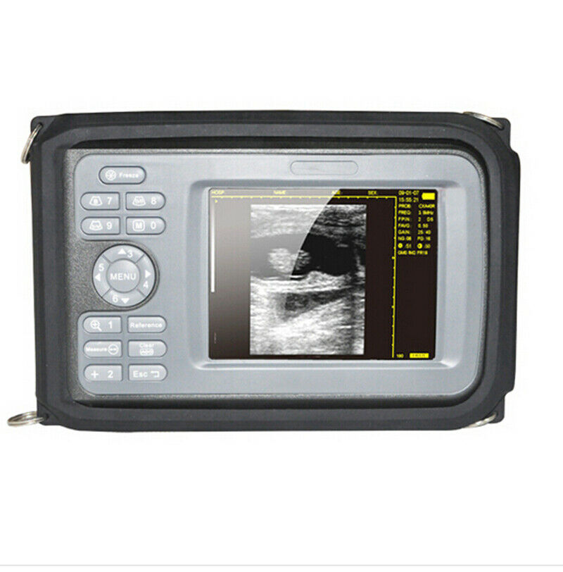 5.5inch Portable Ultrasound Scanner/Machine Digital+Convex Transducer Human Use DIAGNOSTIC ULTRASOUND MACHINES FOR SALE