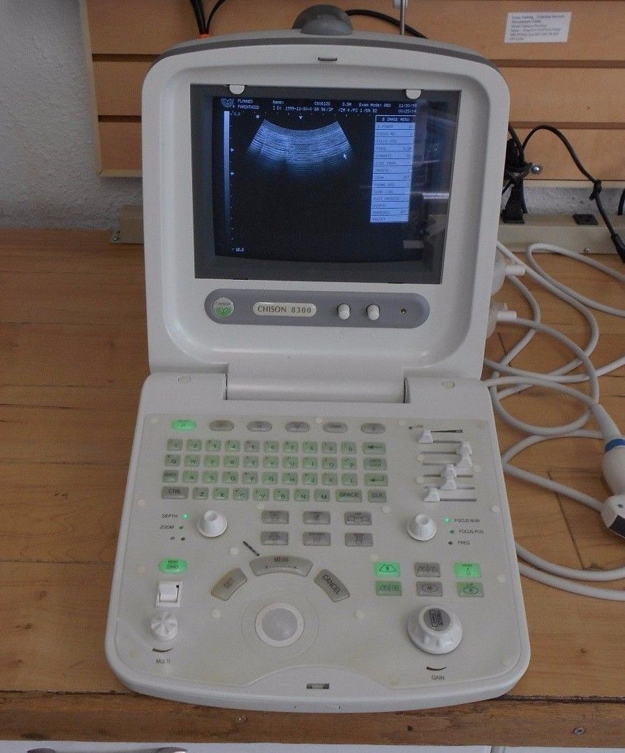 CHISON 8300 Portable Ultrasound with 2 Probes - For Parts - Turned On* DIAGNOSTIC ULTRASOUND MACHINES FOR SALE