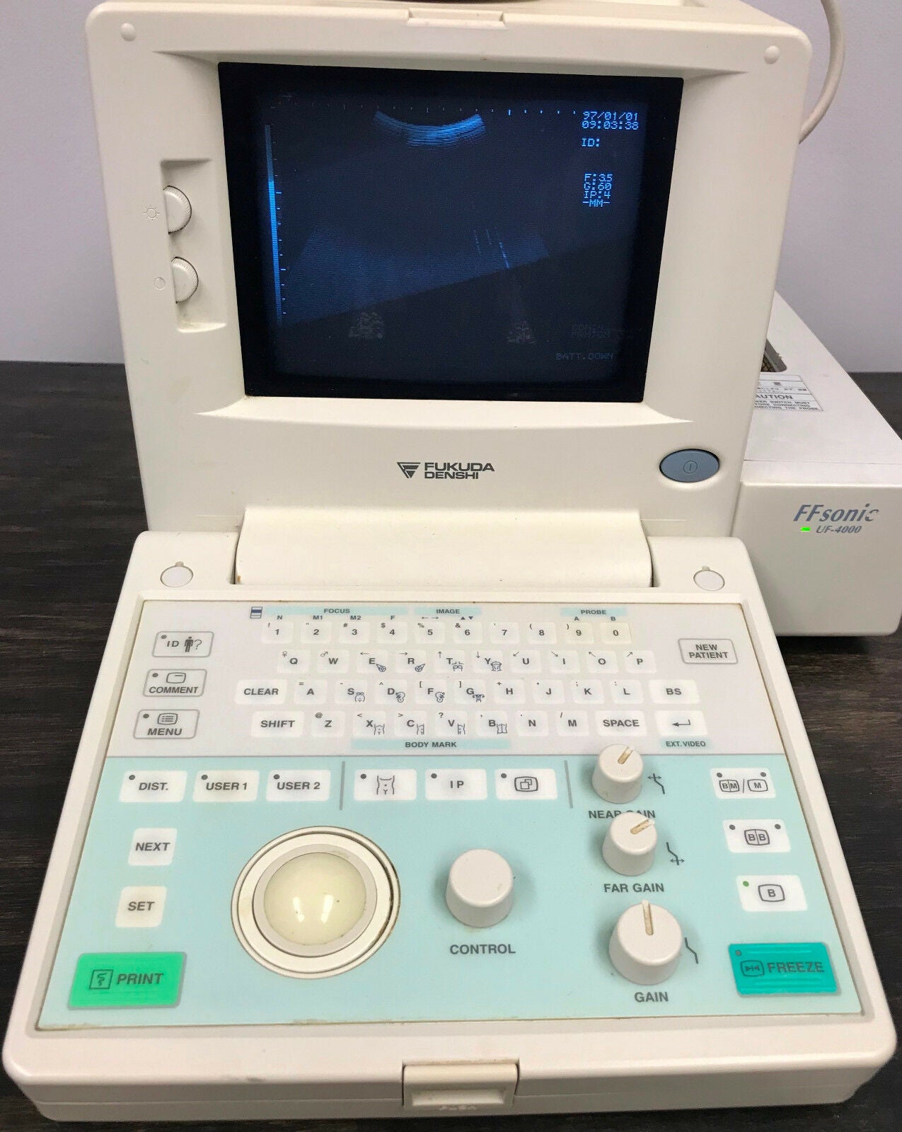 Fukuda Denshi UF-4000 FFSONIC Portable Ultrasound w/ FUT-C111A Transducer Probe DIAGNOSTIC ULTRASOUND MACHINES FOR SALE