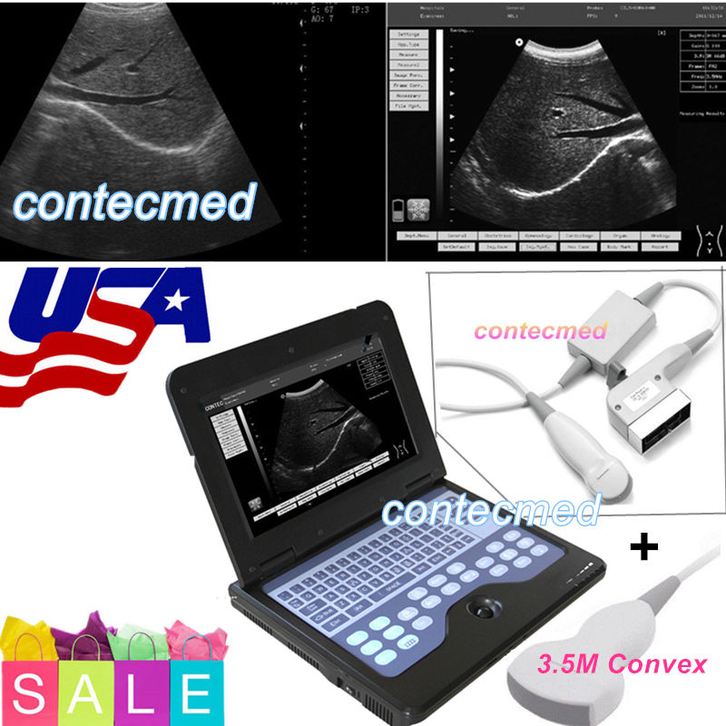 CE Portable Ultrasound Scanner Machine Laptop Diagnostic System(4 Probes Option) DIAGNOSTIC ULTRASOUND MACHINES FOR SALE