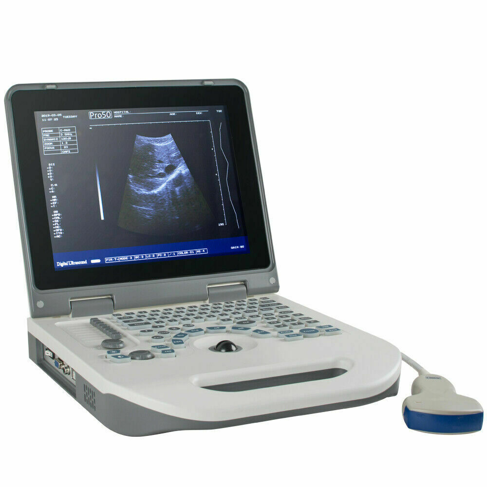 USA Full Digital Ultrasound Scanner Ultrasonic MachineDisgnos Convex Probe 3D CE DIAGNOSTIC ULTRASOUND MACHINES FOR SALE