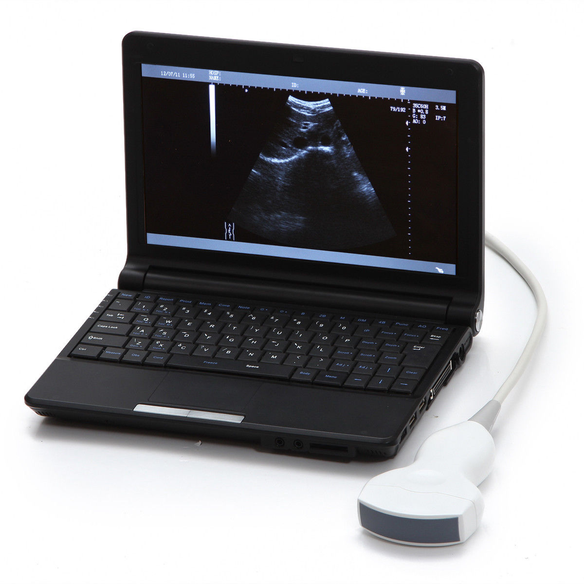 LCD Digital Notebook Ultrasound Scanner with 3.5 MHZ Convex Probe External 3D 190891998767 DIAGNOSTIC ULTRASOUND MACHINES FOR SALE