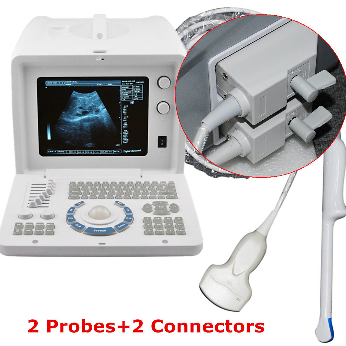 Digital Ultrasound Scanner Machine Unit Convex Transvaginal 2 Probe 3D Scan 190891774187 DIAGNOSTIC ULTRASOUND MACHINES FOR SALE