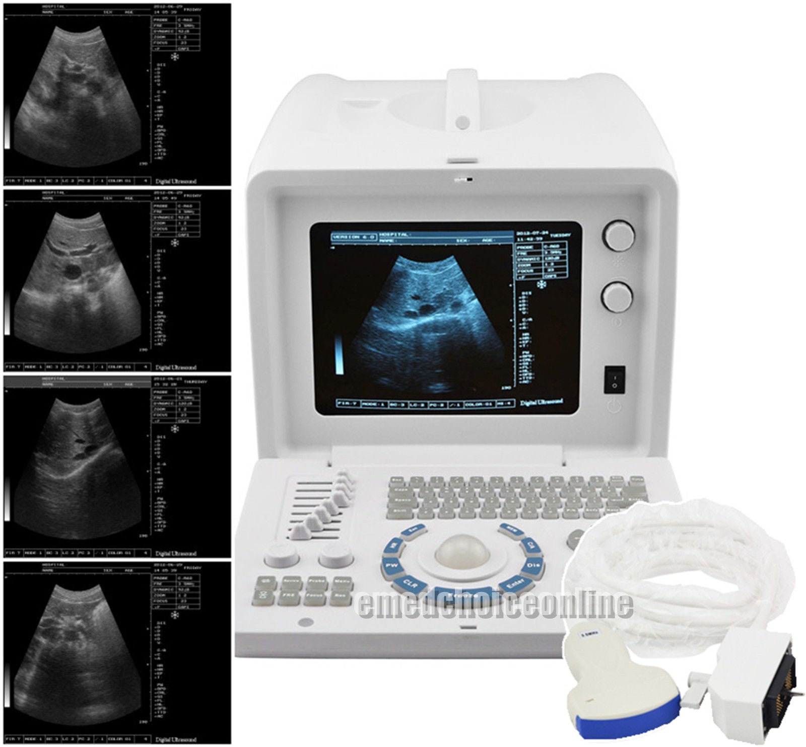 Excellent 10"Digital Ultrasound Machine Covex/ Linear/ Transvaginal 3 Probes Kit DIAGNOSTIC ULTRASOUND MACHINES FOR SALE