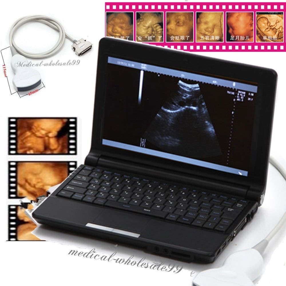 Digital Ultrasonic Ultrasound Scanner +Convex Vignal &Linear 3 Probe Fee 3D Sale 190891823137 DIAGNOSTIC ULTRASOUND MACHINES FOR SALE