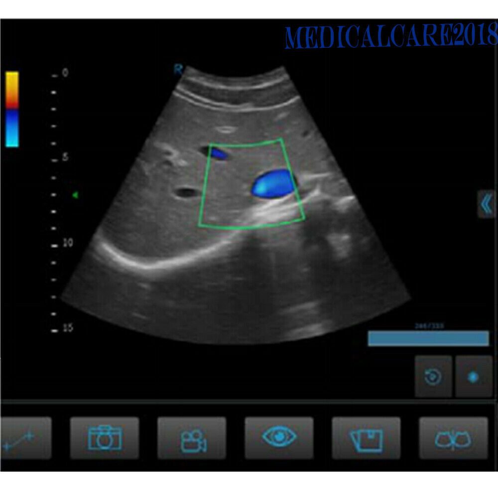 New Mindray 3C5P Convex Array Ultrasound Probe for Z-6 M6, Compatible Transducer DIAGNOSTIC ULTRASOUND MACHINES FOR SALE