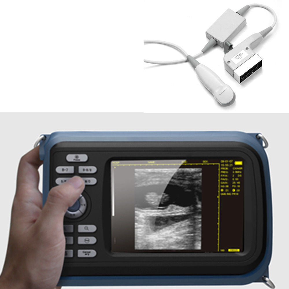 5.5“ Digital Portable Handheld Ultrasound Scanner Cardiac+Micro-convex Probe CE 190891716408 DIAGNOSTIC ULTRASOUND MACHINES FOR SALE