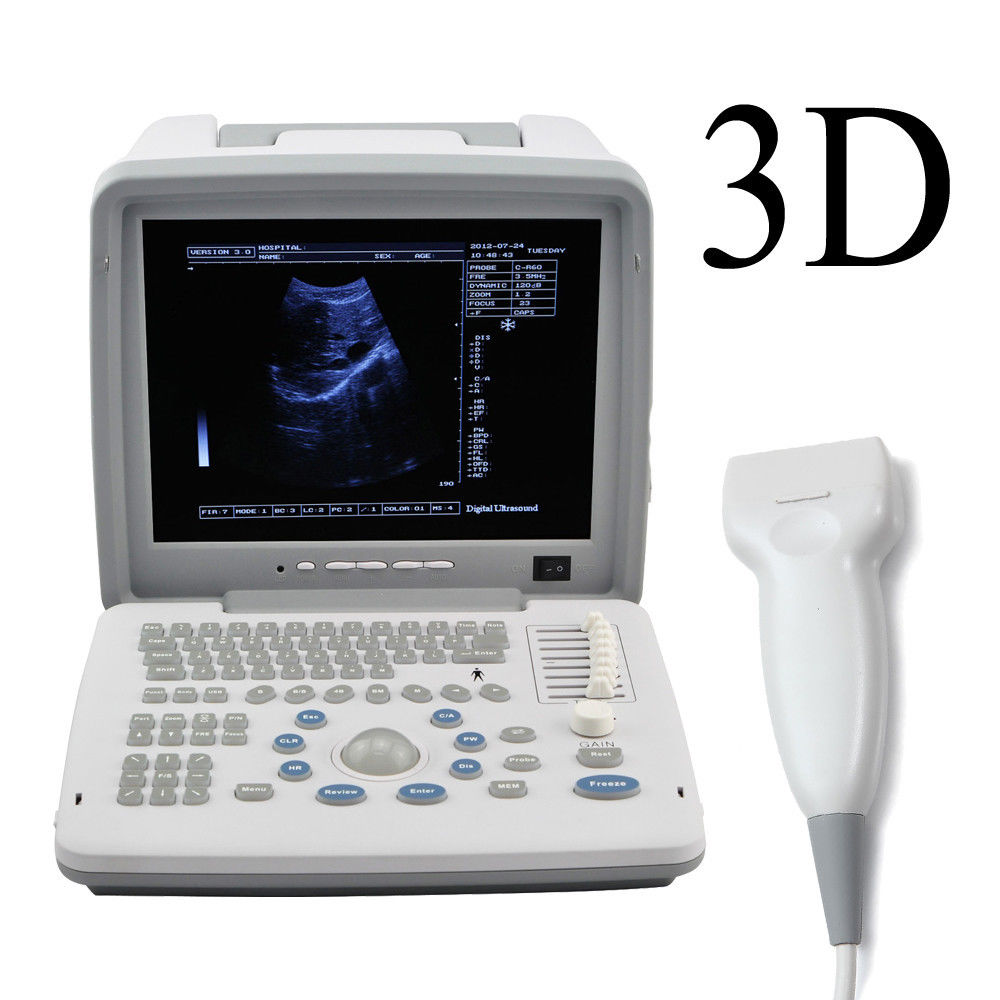 Carejoy Digital Ultrasound Scanner Monitor with 7.5Mhz Linear Probe Pregnancy CE DIAGNOSTIC ULTRASOUND MACHINES FOR SALE