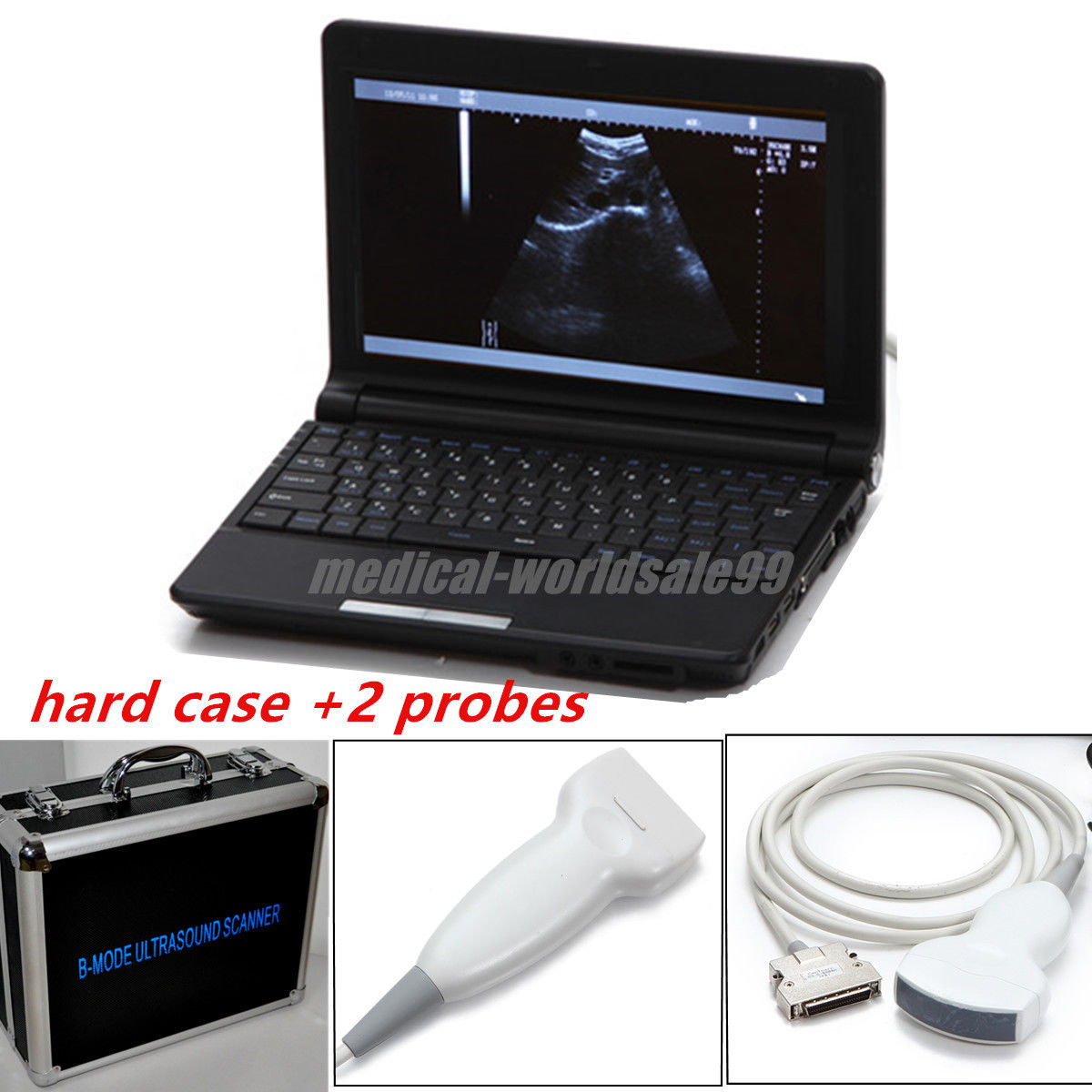 Portable 3D Digital Ultrasound Scanner/Machine Convex Linear 2 Probes With Case 190891387462 DIAGNOSTIC ULTRASOUND MACHINES FOR SALE