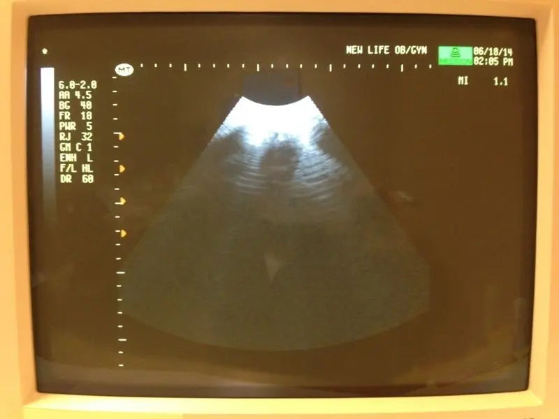 Medison Voluson 530D MT 3D/4D Ultrasound – DIAGNOSTIC ULTRASOUND