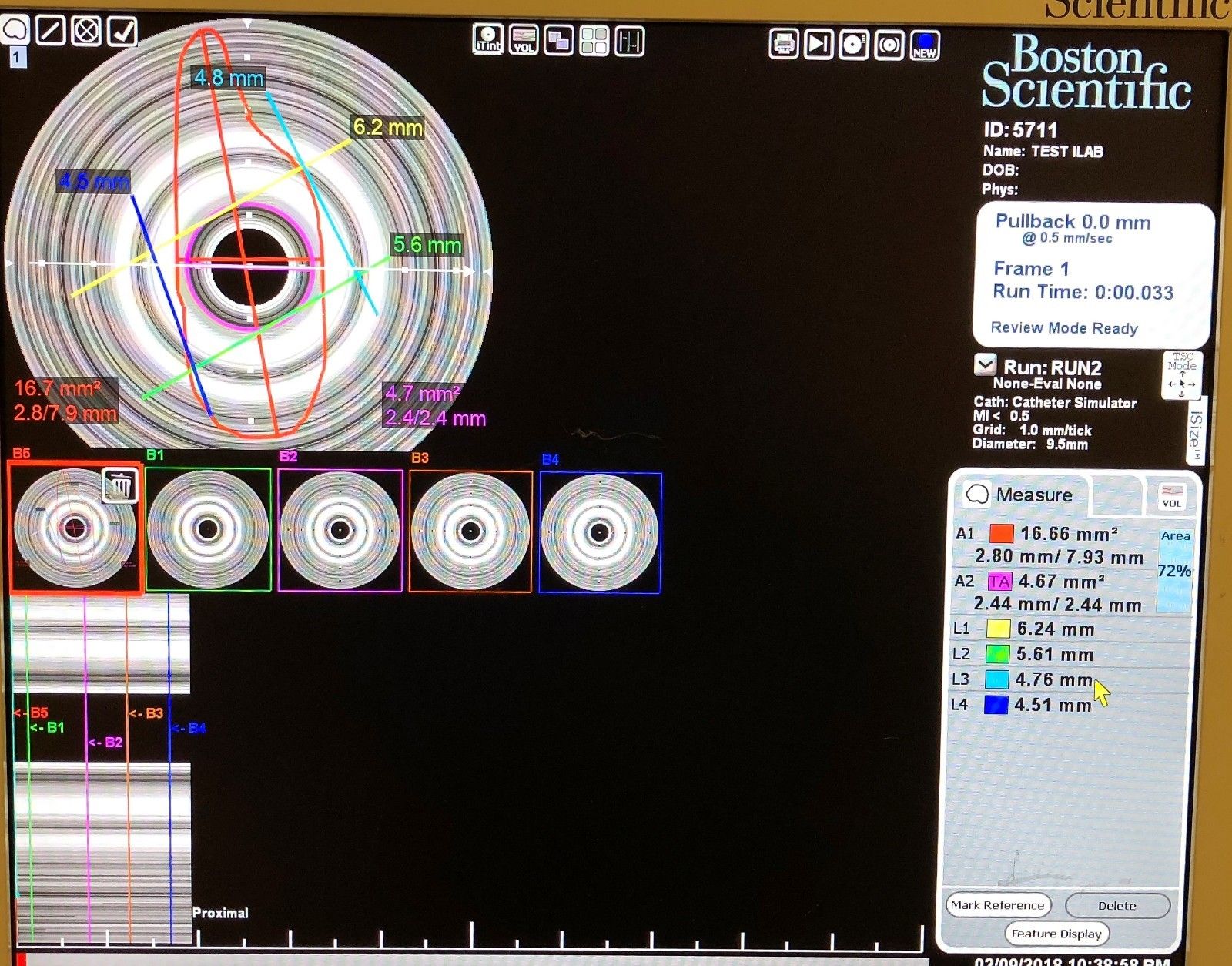 Boston Scientific iLab  Ultrasound Imaging System with 2 Probes & More DIAGNOSTIC ULTRASOUND MACHINES FOR SALE