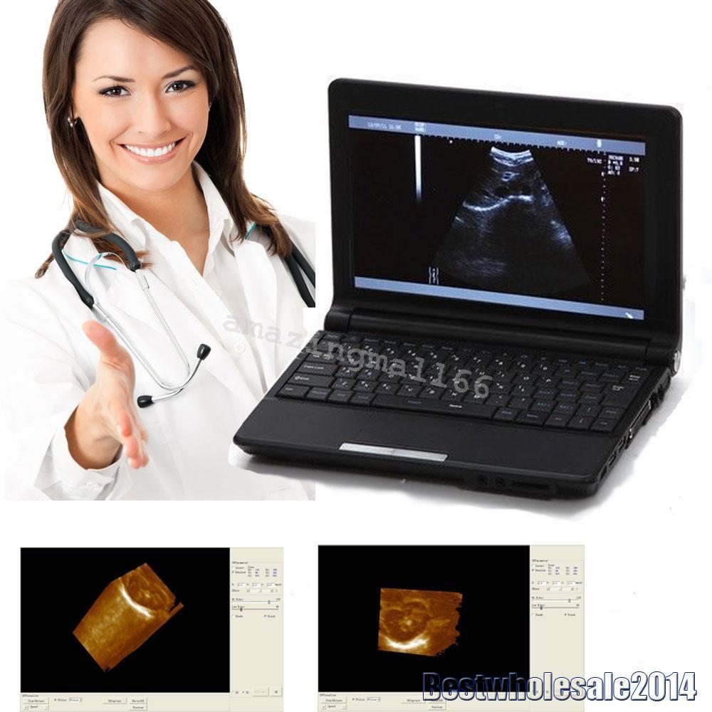 Digital Laptop Machine Ultrasound Scanner + 7.5 Linear Probe/Transducer  +3D CE 190891468864 DIAGNOSTIC ULTRASOUND MACHINES FOR SALE