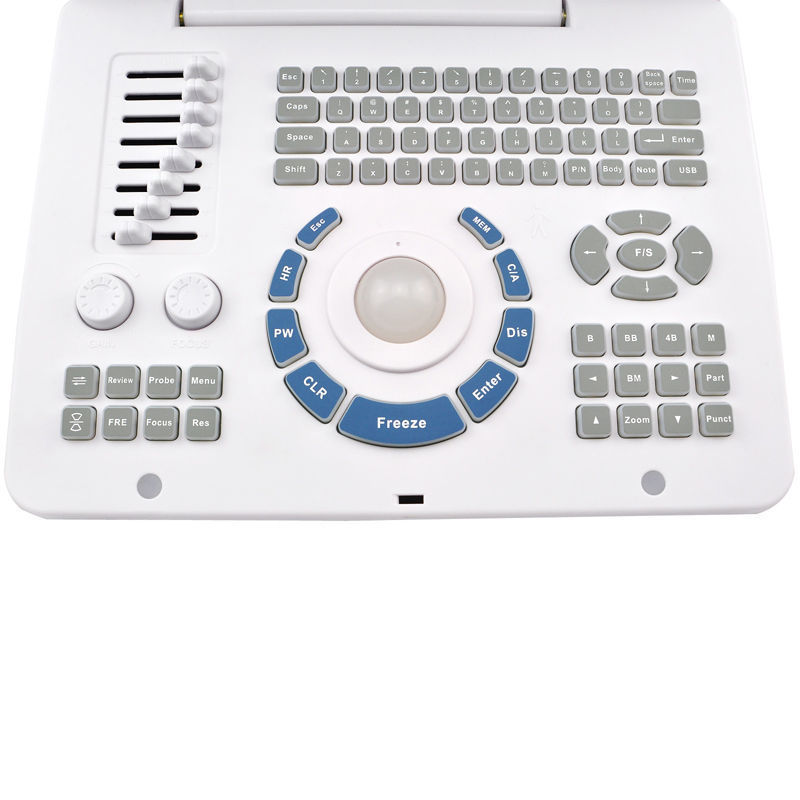 Clear Ultrasound Scanner RUS-6000D with Convex+Transvaginal Probe DIAGNOSTIC ULTRASOUND MACHINES FOR SALE