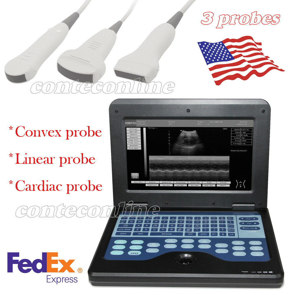 Ultrasound Scanner Laptop Machine with 3 probe-Convex/Linear/Cardiac probe DIAGNOSTIC ULTRASOUND MACHINES FOR SALE