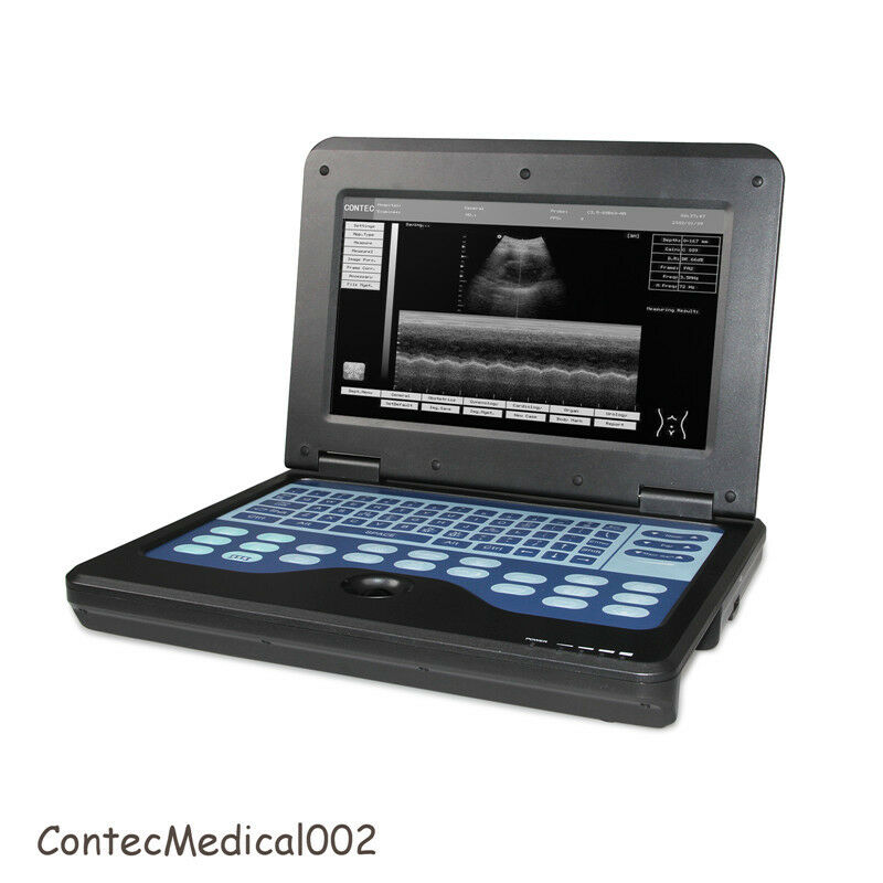 Portable laptop machine Digital Ultrasound scanner, Free 3.5Mhz Convex probe,USA 6945040100362 DIAGNOSTIC ULTRASOUND MACHINES FOR SALE