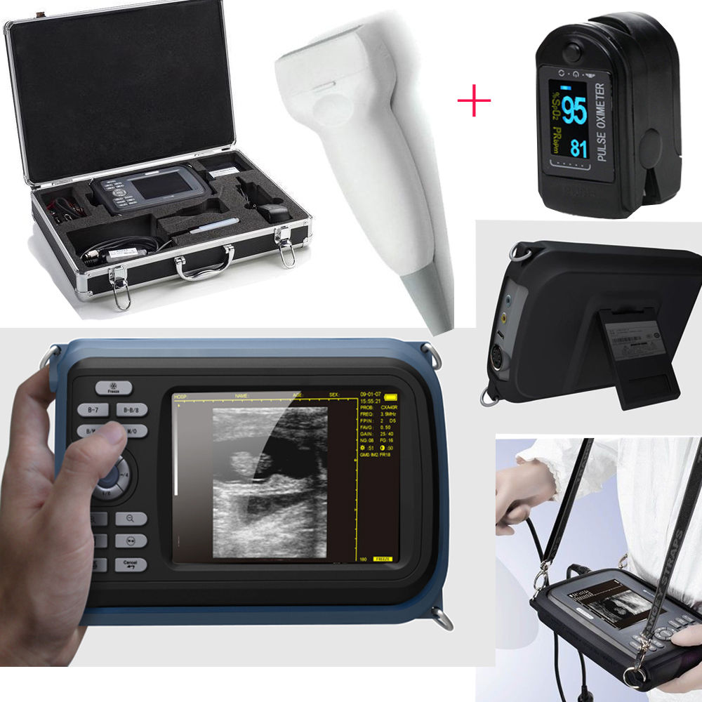 Handheld Full Digital Ultrasound Scanner Machine System Linear Probe+ Oximeter 190891044433 DIAGNOSTIC ULTRASOUND MACHINES FOR SALE