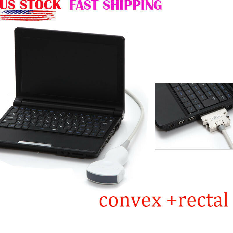 Ultrasound Scanner Laptop Machine Ultrasonic Machine Convex Rectal Transducer DIAGNOSTIC ULTRASOUND MACHINES FOR SALE