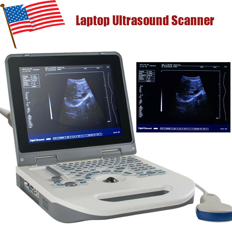 Notebook Digital Laptop Ultrasound Scanner Diagnostic System 3.5MHz Convex+3D DIAGNOSTIC ULTRASOUND MACHINES FOR SALE