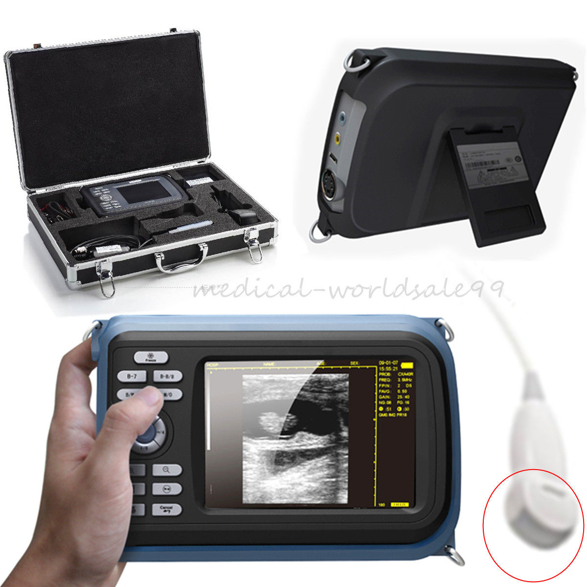 VET Handheld Ultrasound Scanner Machine  + Micro-Convex Probe/Sensor Animal CE 190891523389 DIAGNOSTIC ULTRASOUND MACHINES FOR SALE