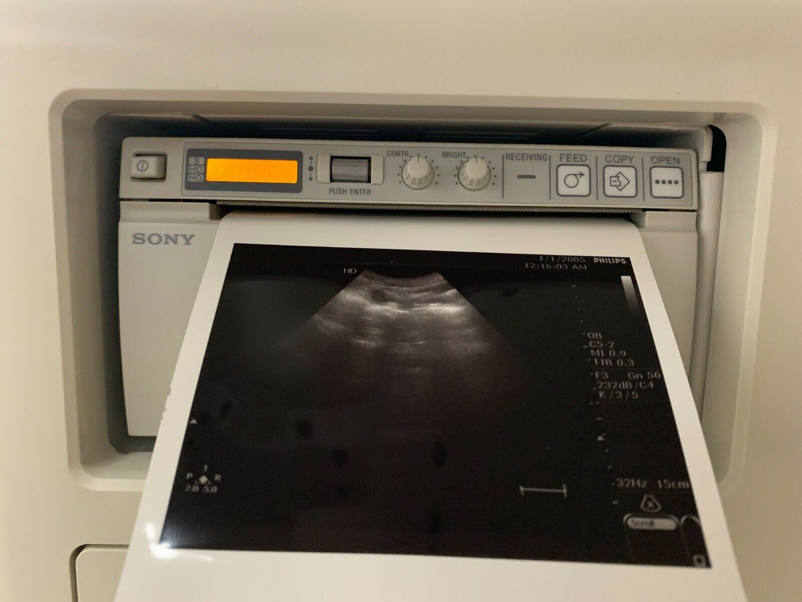 Philips HD7XE Ultrasound System (DOM: July 2010) w/ C5-2 Transducer Probe DIAGNOSTIC ULTRASOUND MACHINES FOR SALE