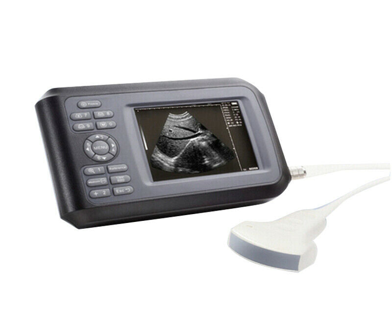 Human Medical Handheld Ultrasound Scanner Machine 3.5mhz Convex Probe Hospital DIAGNOSTIC ULTRASOUND MACHINES FOR SALE