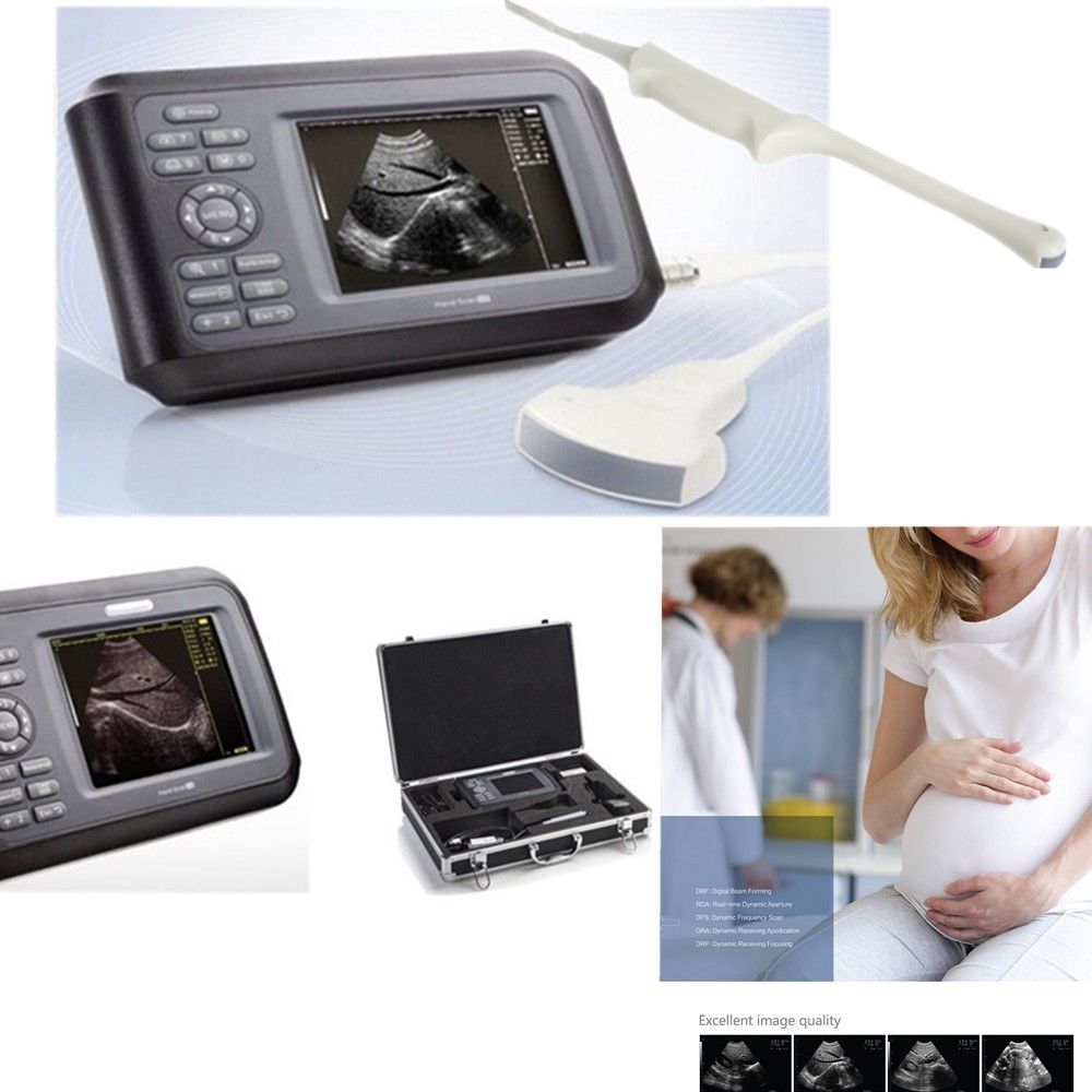 Laptop Machine HandScan Ultrasound scanner Convex +Linear+ Cardiac Heart 3 Probe 190891048707 DIAGNOSTIC ULTRASOUND MACHINES FOR SALE