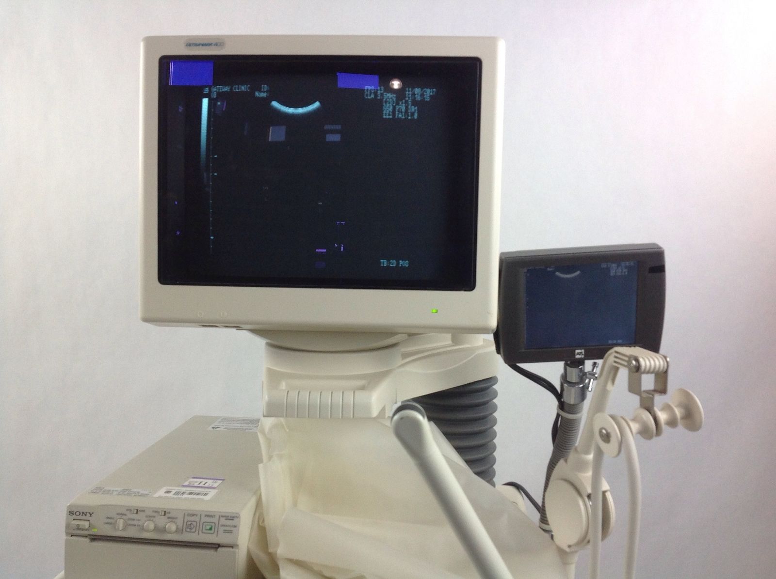 ATL Ultramark 400 Ultrasound W/ CLA 35/40, 6.5 mHz Probes And FootSwitch DIAGNOSTIC ULTRASOUND MACHINES FOR SALE