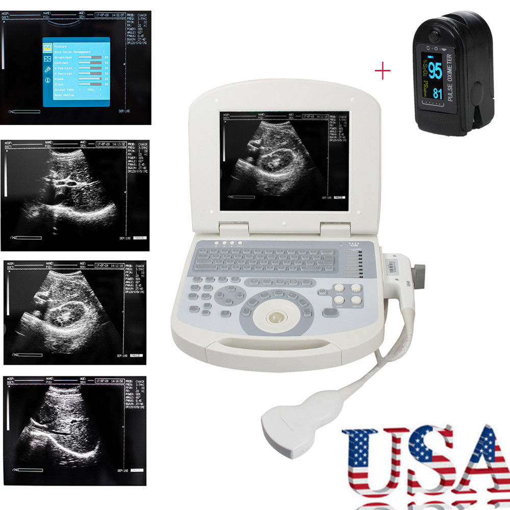 US High Resolution Digital Laptop Medical Ultrasound Scanner Convex probe 3.5MHZ 190891422491 DIAGNOSTIC ULTRASOUND MACHINES FOR SALE