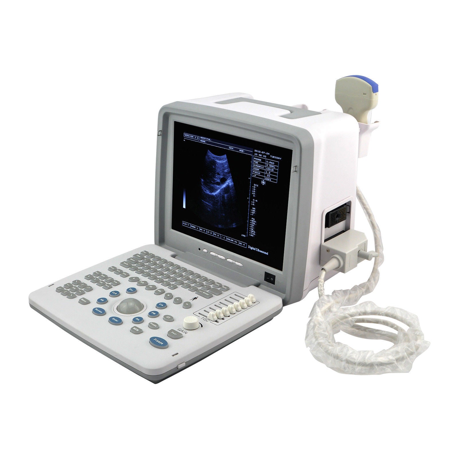 Digital Ultrasound Scanner Machine Convex/Linear/Transvaginal 3 Probes UPS DIAGNOSTIC ULTRASOUND MACHINES FOR SALE