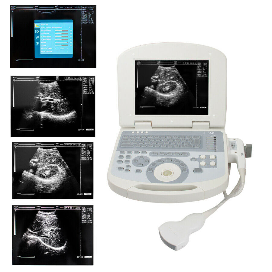 USA 10.4 inch Digital Laptop Medical Ultrasound Scanner 3.5MHZ Convex Probe USA DIAGNOSTIC ULTRASOUND MACHINES FOR SALE