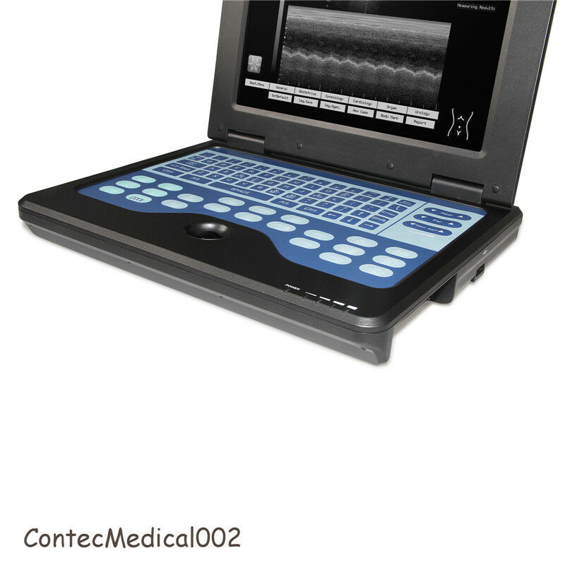 Portable laptop machine Digital Ultrasound scanner, Free 3.5Mhz Convex probe,USA 6945040100362 DIAGNOSTIC ULTRASOUND MACHINES FOR SALE