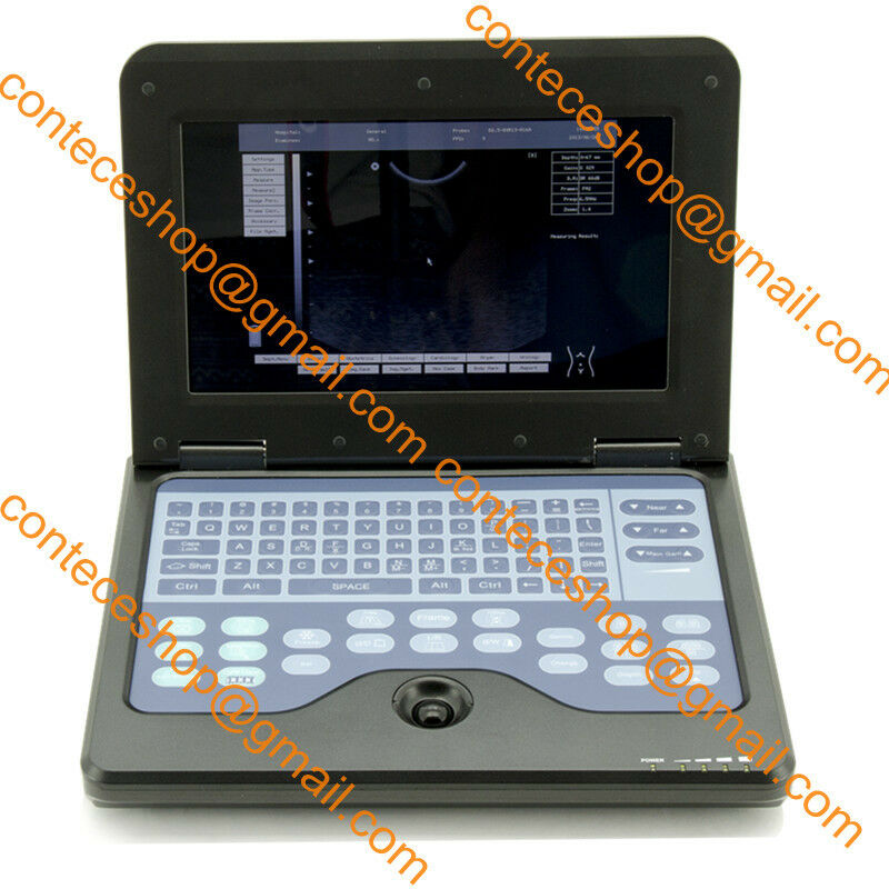 VET Animal Ultrasound Scanner 3.5 Convex Probe Portable Laptop Machine Fedex USA 658126883672 DIAGNOSTIC ULTRASOUND MACHINES FOR SALE