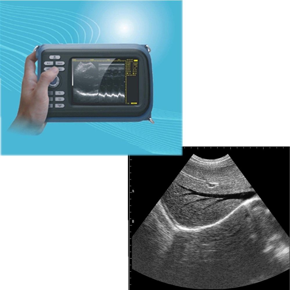 Laptop Machine HandScan Ultrasound scanner Convex + Linear+ Micro Convex Probe DIAGNOSTIC ULTRASOUND MACHINES FOR SALE