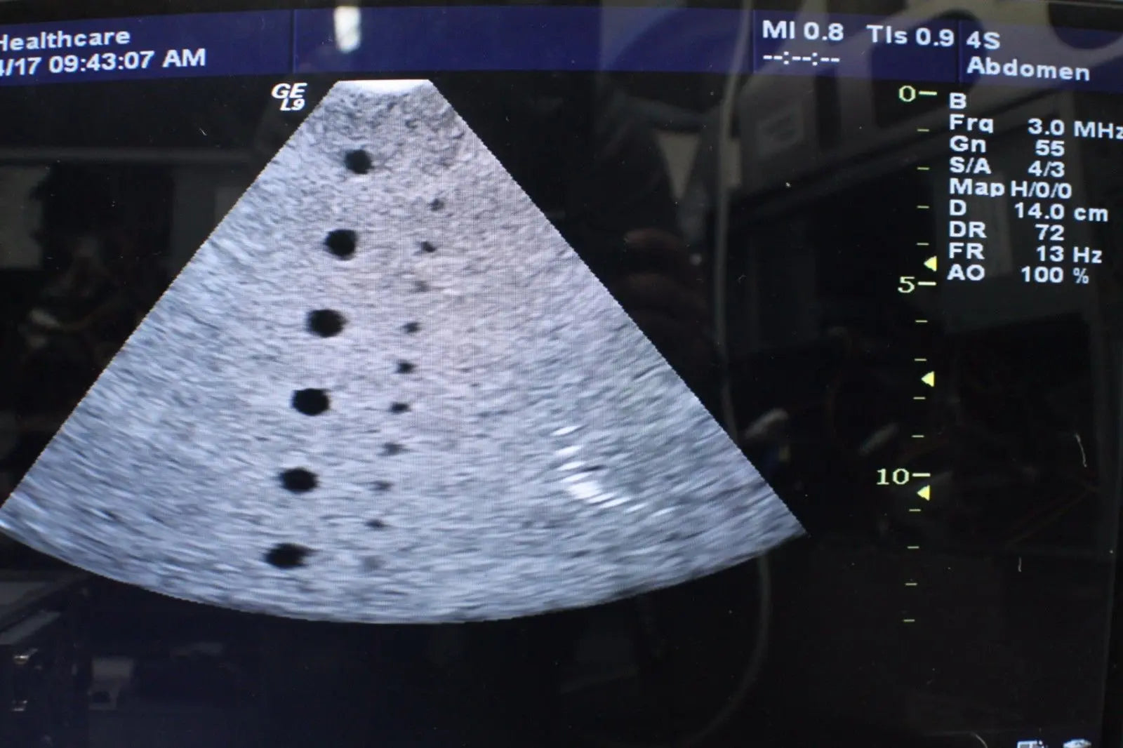 GE 4S Ultrasound Sector Probe DIAGNOSTIC ULTRASOUND MACHINES FOR SALE