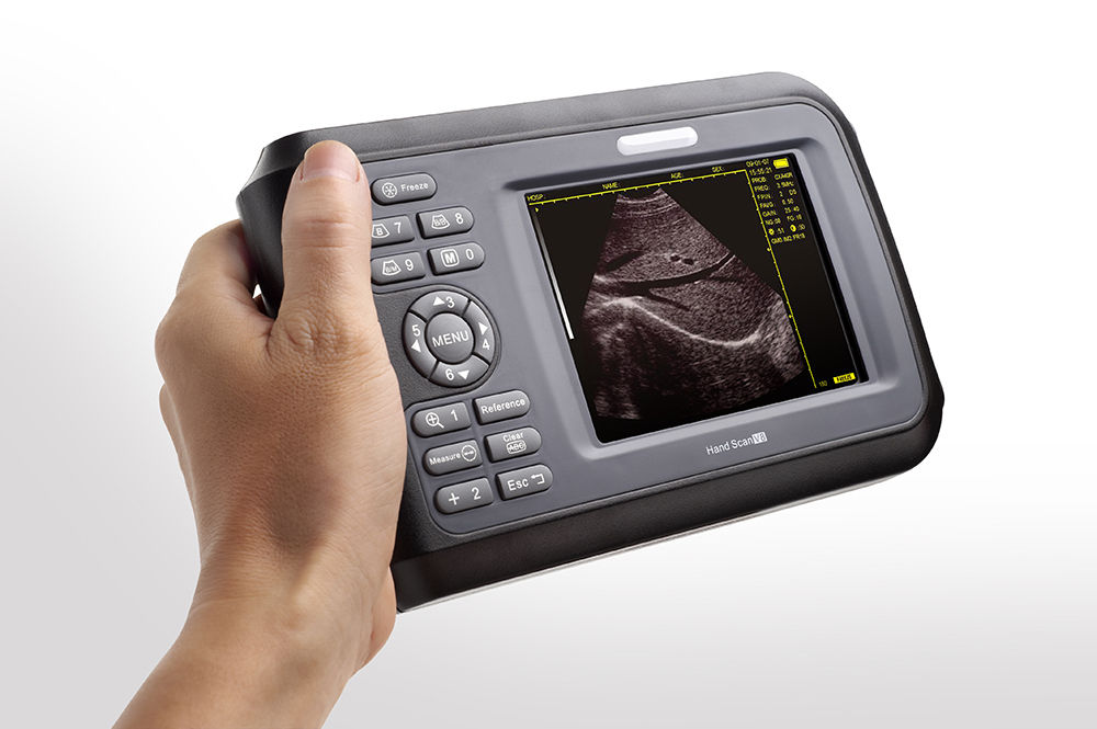 5.5“ Digital Portable Handheld Ultrasound Scanner Cardiac+Micro-convex Probe CE 190891716408 DIAGNOSTIC ULTRASOUND MACHINES FOR SALE