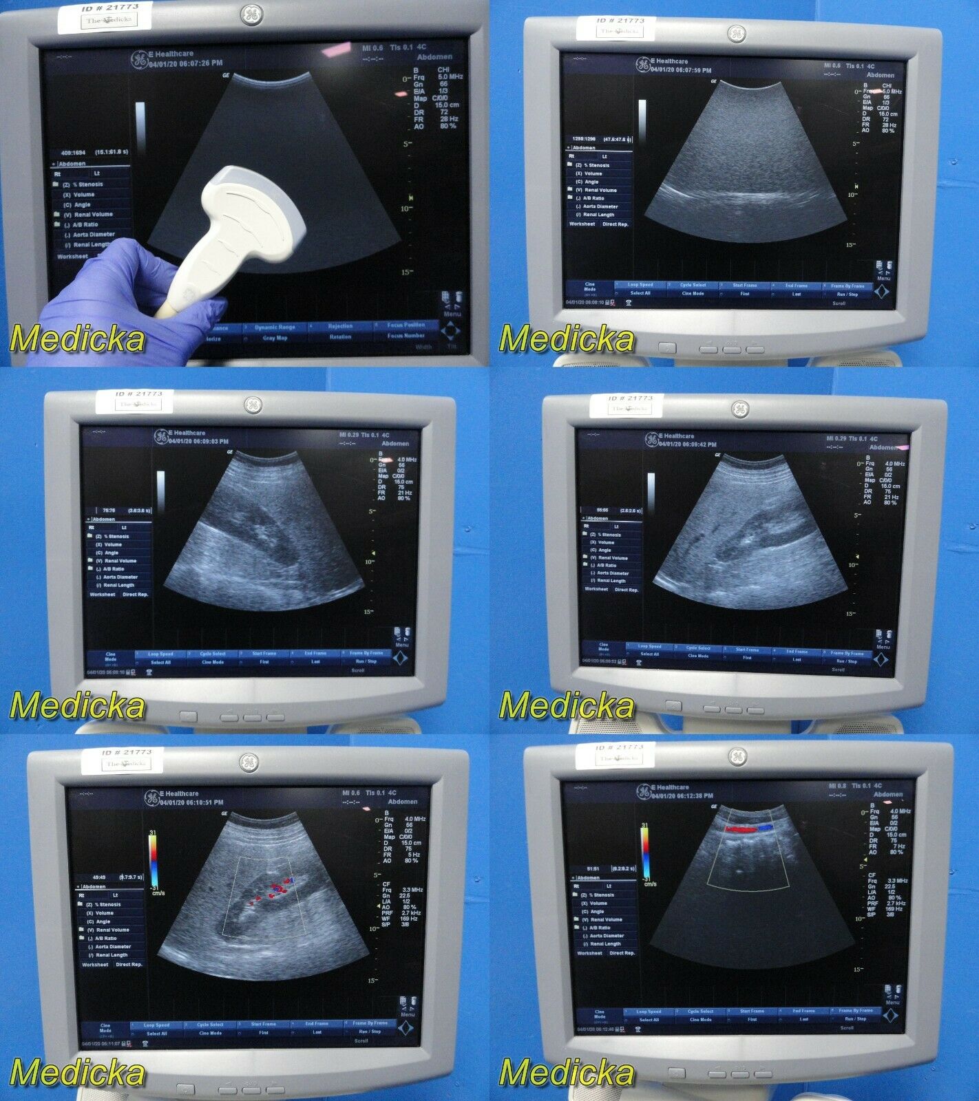 2008 GE LogiQ P5 Flat-Screen Ultrasound W/ 4C & 12L Transducers / Probes ~ 21773 DIAGNOSTIC ULTRASOUND MACHINES FOR SALE